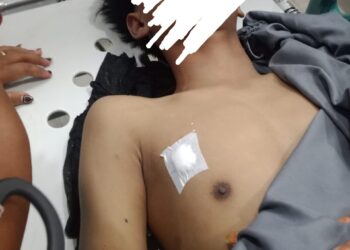 Tawuran di Medan Belawan Seorang Warga Meninggal Dunia Terkena Panah Beracun 