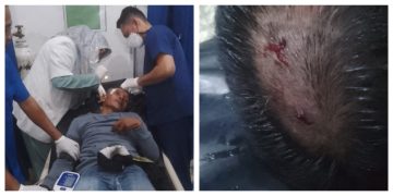 Oknum Penggarap Lahan Lakukan Penembakan Senapan Angin ke Karyawan Pemanen dan Security PT Bakrie Sumatera Plantations Tbk 